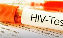 Der AIDS Test